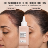 Andreia Professional – Quitamanchas de tinte suave para la piel 100 ml